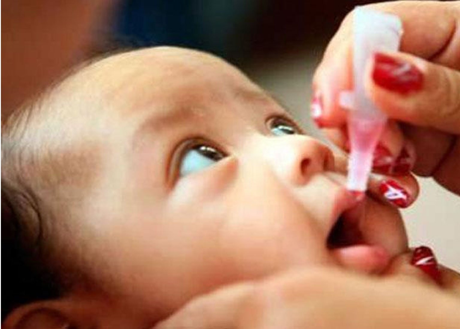 पोलियो के लक्षण , रोकथाम और उपचार